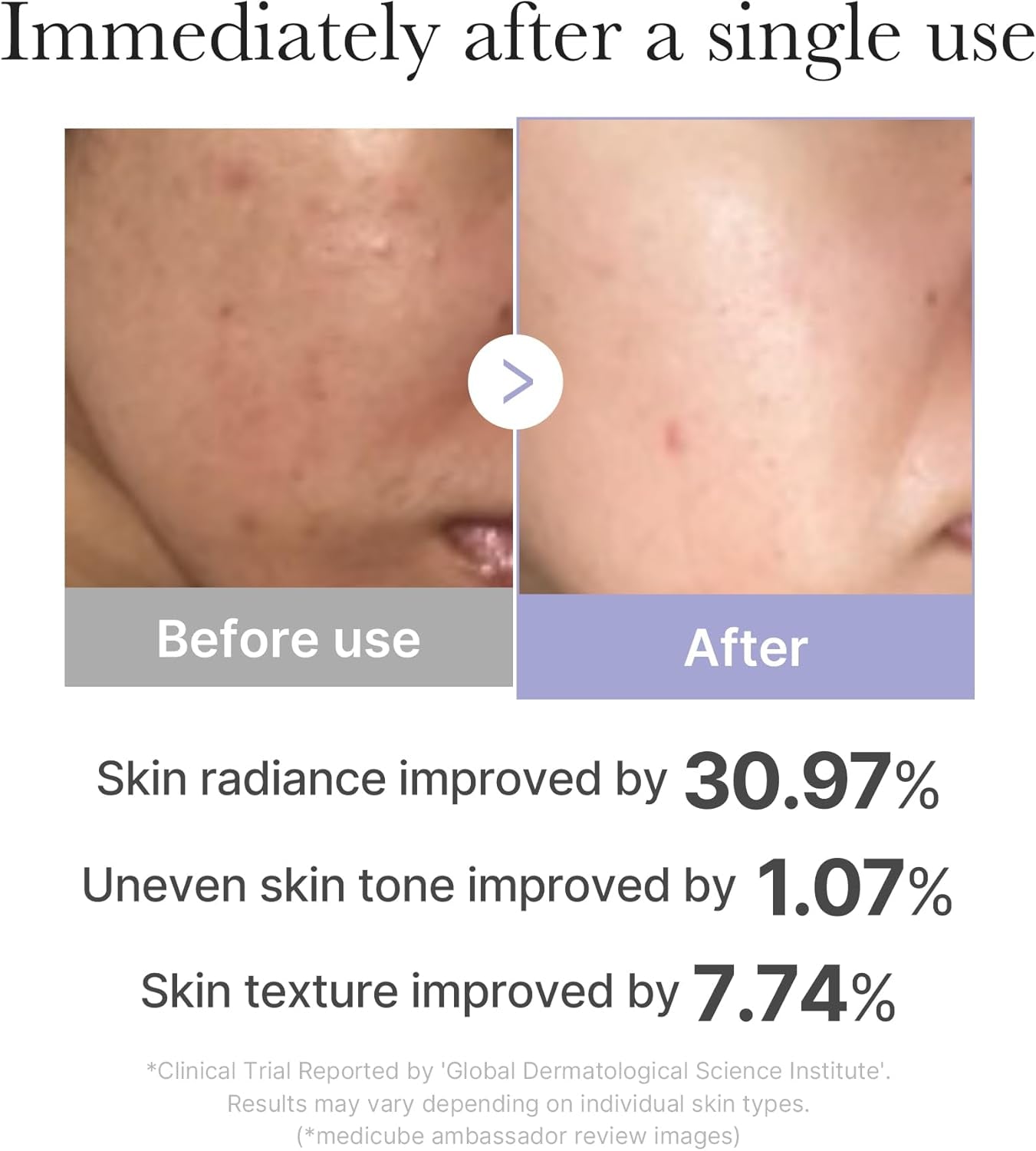 Mini Booster Pro Pink | Affordable At-Home Facial Skin Care Tool for Beginners - Portable Glow Booster for Glass Skin, Boosting Skin Care Absorption, Skin Care for Teens, Korean Skin Care-Package May Vary